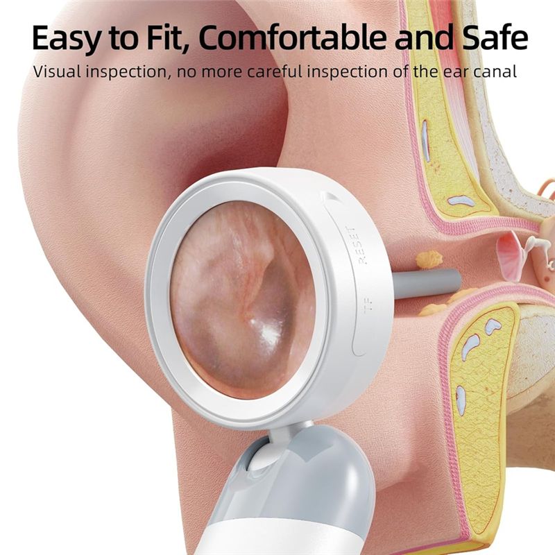 LXYB18B Wireless Ear Otoscope  - Photography Lighting Gear 评论和价格