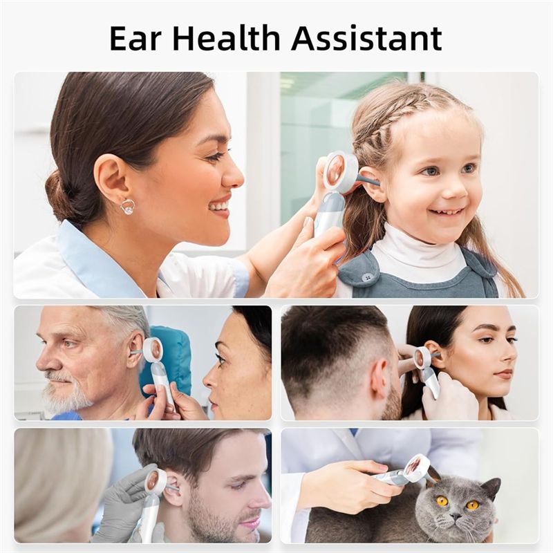LXYB18B Wireless Ear Otoscope  - Photography Lighting Gear 评论和价格